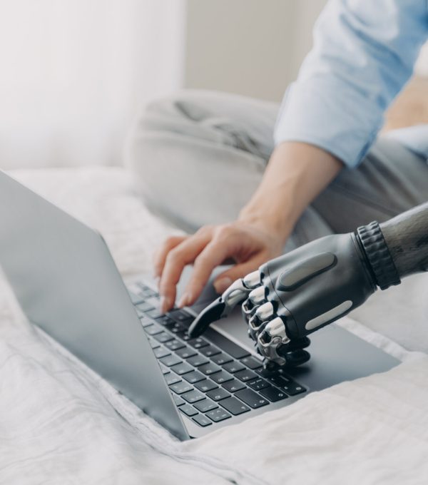 Bionic prosthesis and healthy arm. Hands of disabled girl are typing on keyboard of laptop. Handicapped european woman with artificial limb working on pc at home. Bionic fingers on buttons.